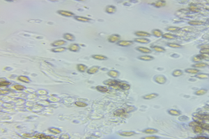 Ein Nahaufnahme-Mikroskopbild von zahlreichen kleinen, runden Mikroorganismen.